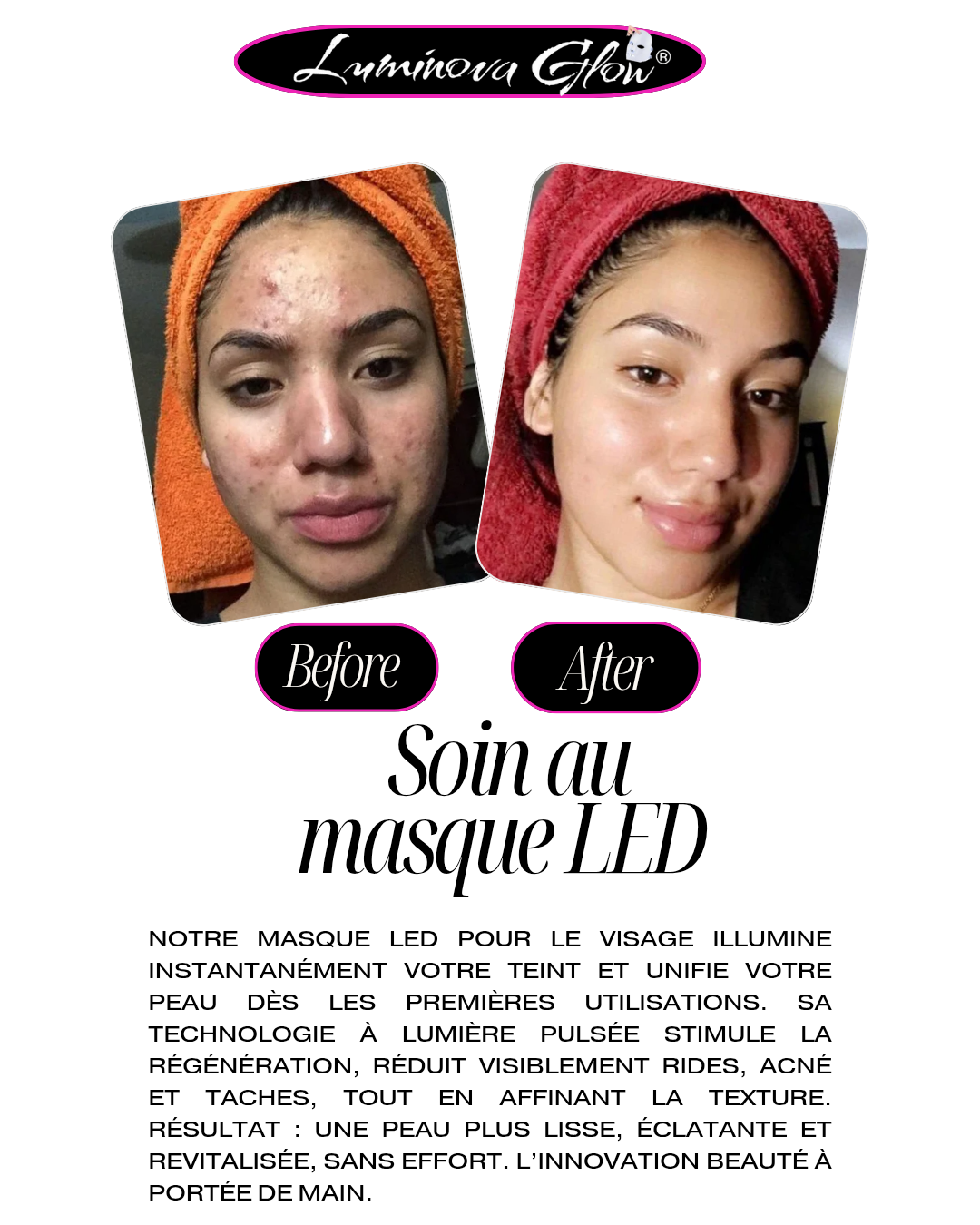 MASQUE DE BEAUTÉ
